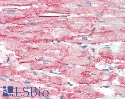 IHC-plus™ SGCA / DAG2 Antibody