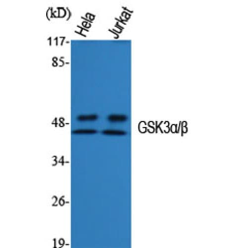Polyclonal Rabbit anti-Human GSK3 Alpha+Beta Antibody (220-300 aa, IHC, WB)