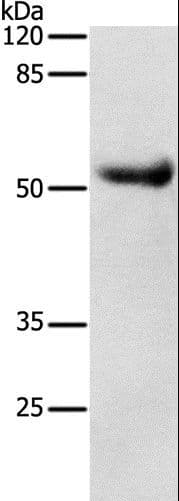 Polyclonal Rabbit anti-Human DRD4 / Dopamine Receptor D4 Antibody (IHC, WB)