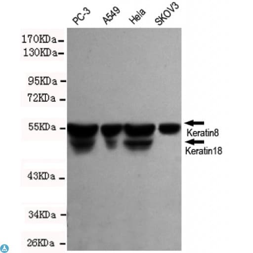 KRT8 / CK8 / Cytokeratin 8 Antibody
