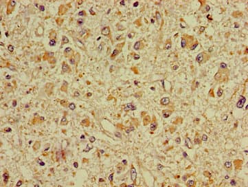 Polyclonal Rabbit anti-Human DPYSL2 / CRMP2 Antibody (IHC, IF, WB)