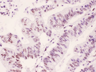 PML Antibody