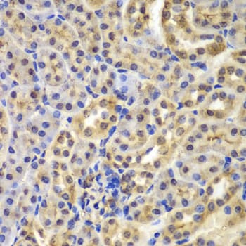 Polyclonal Rabbit anti-Human NFKBIA / IKB Alpha / IKBA Antibody (IHC, IF, WB)