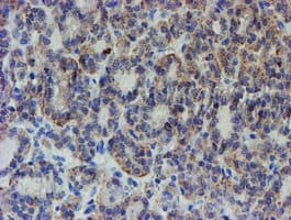 ZNF365 Antibody (aa108-407, clone OTI2D9)