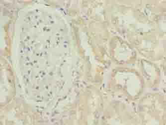 POGZ Antibody