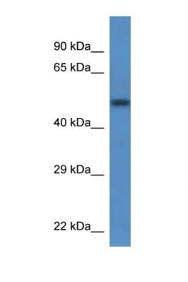 TCN2 Antibody (aa40-89)