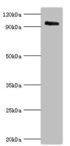 CAPN3 / Calpain 3 Antibody (aa582-821)
