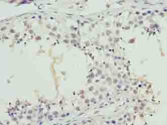 Polyclonal Rabbit anti-Human SYNJ2BP / OMP25 Antibody (IHC, WB)