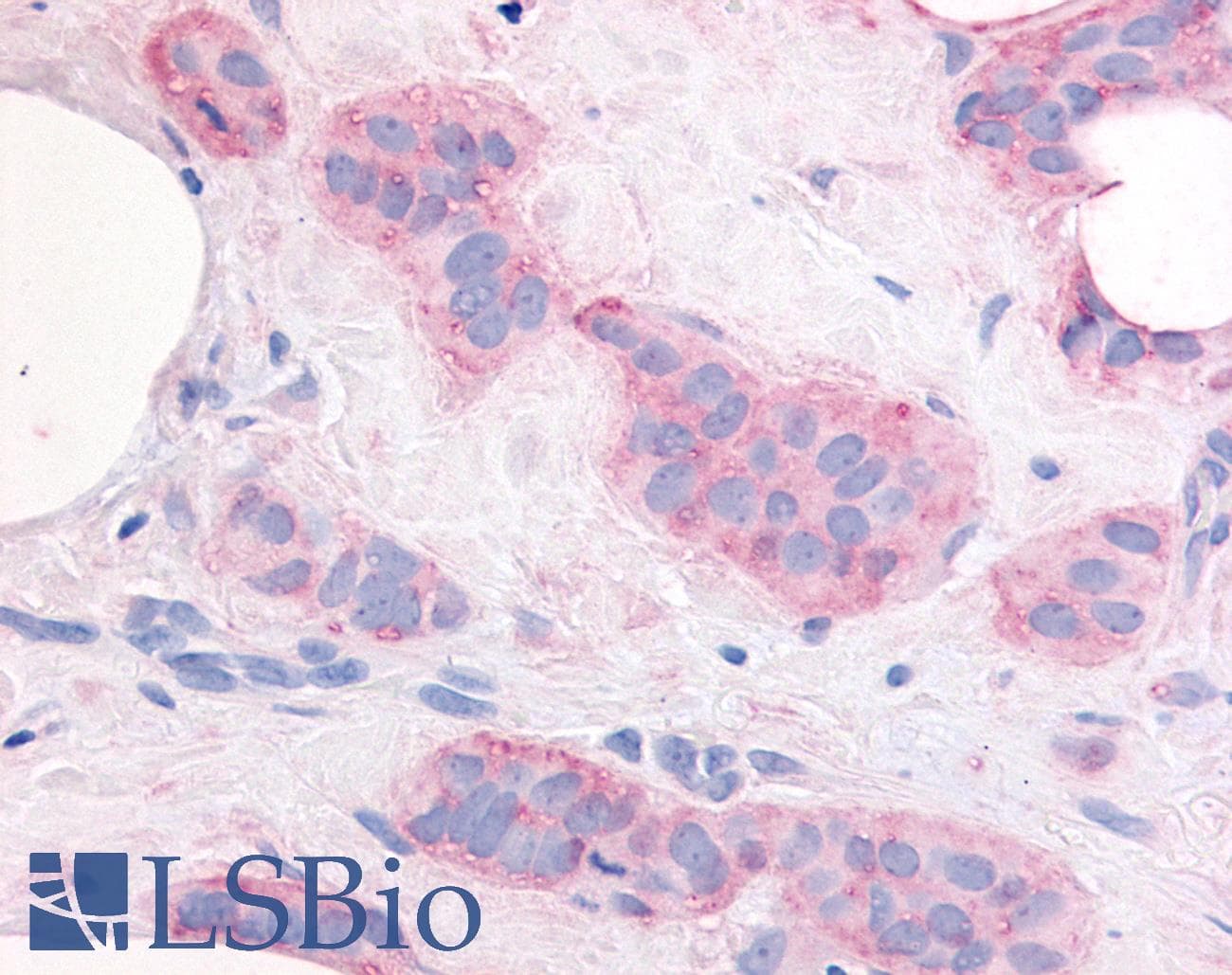 IHC-plus™ KDR / VEGFR2 / FLK1 Antibody (Internal)