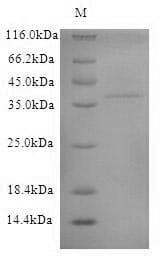 Dog Trypsin Protein (Recombinant 6His-SUMO, N-terminus)