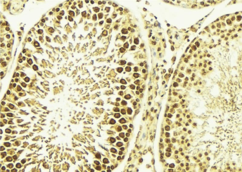 CAMK4 / CaMK IV Antibody (phospho-Thr196,pThr200)