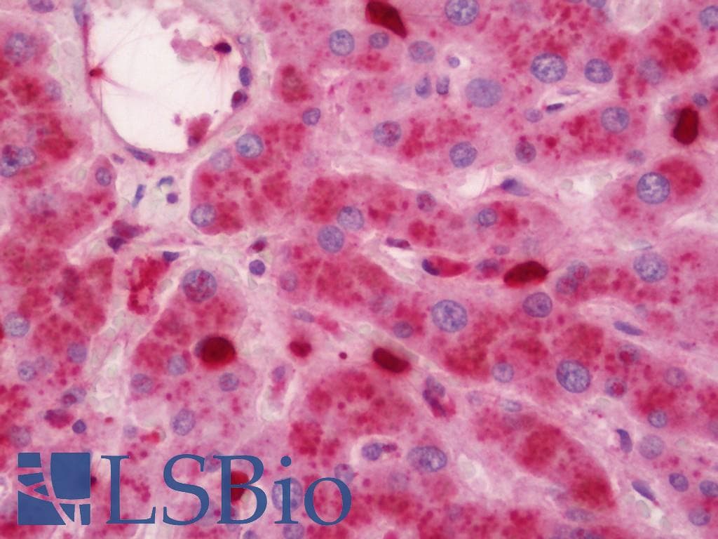 IHC-plus™ S100A10 Antibody (aa3-52)
