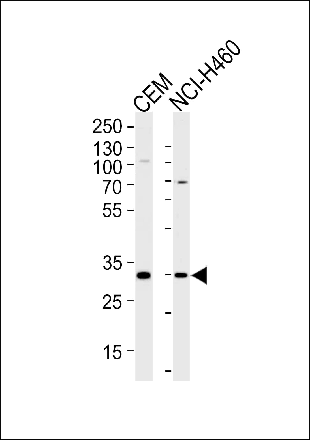 H2AFY2 Antibody (aa148-169)