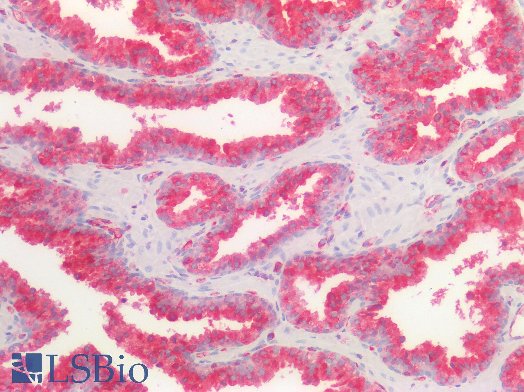 PathPlus™ B2M / Beta 2 Microglobulin Antibody (clone OTI1A9)