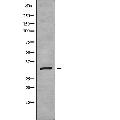 Polyclonal Rabbit anti-Human RPL7A / Ribosomal Protein L7a Antibody (WB)