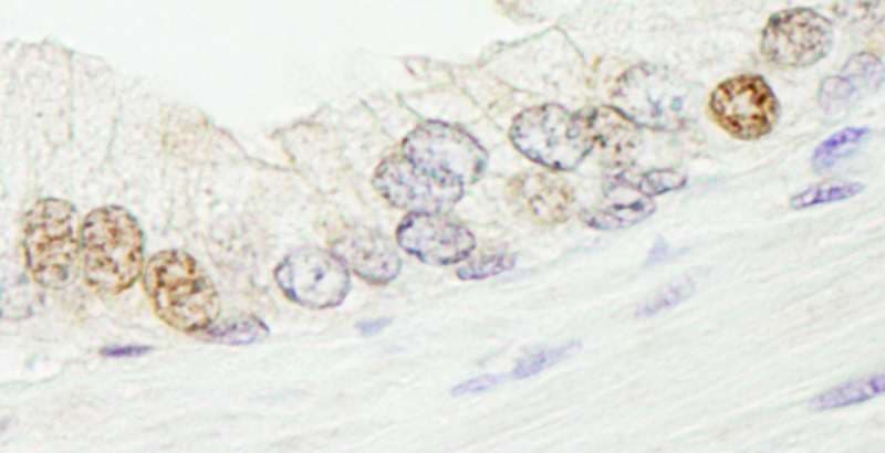 SMARCA1 / SWI Antibody (aa1004-1054)