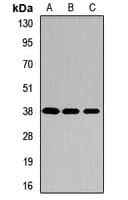 ARA9 / AIP Antibody