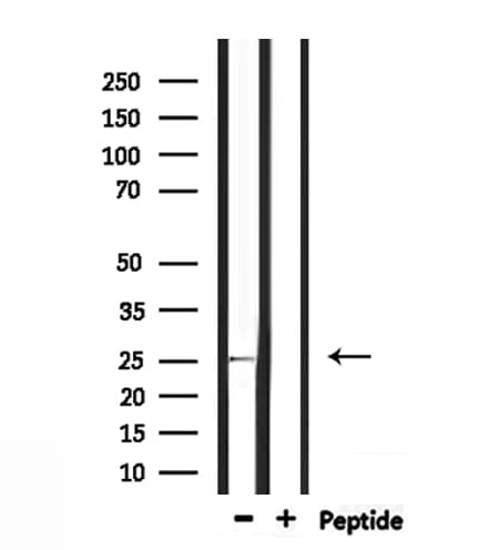 RAB32 Antibody