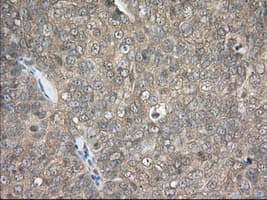 Monoclonal Mouse anti-Human PDE4A / PDE4 Antibody (clone OTI6D6, IHC, IF, WB)