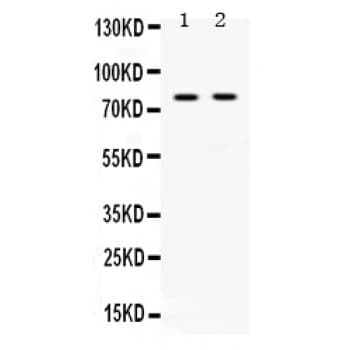 TF / Transferrin Antibody (aa20-49)