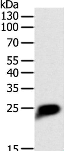 Polyclonal Rabbit anti-Human CRP / C-Reactive Protein Antibody (IHC, WB)