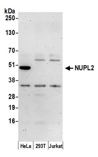 NUPL2 Antibody (aa150-200)