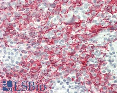 PathPlus™ KRT5 / CK5 / Cytokeratin 5 Antibody (aa316-590, clone 2C2B4)