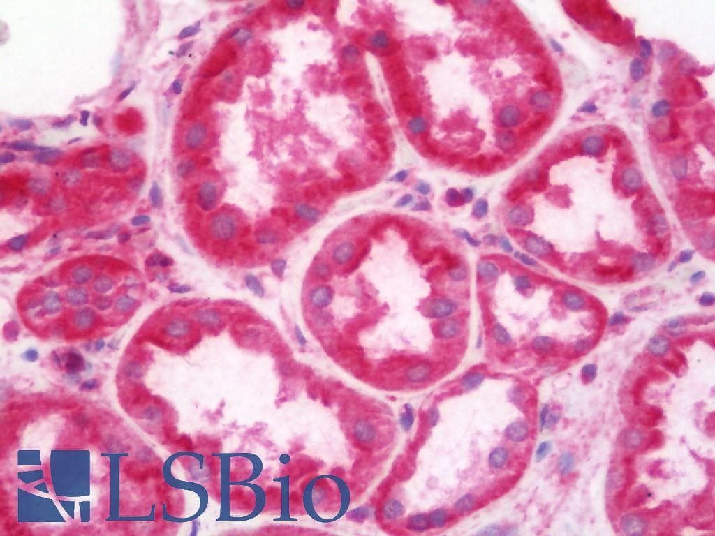 IHC-plus™ Monoclonal Rabbit anti-Human RALA / RAL Antibody (clone EPR6468, Internal, IHC, WB)