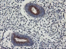 KCNJ3 / GIRK1 Antibody (clone OTI1G3)