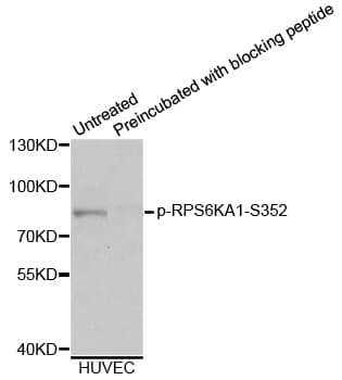 RPS6KA1 / RSK1 Antibody (phospho-Ser352)