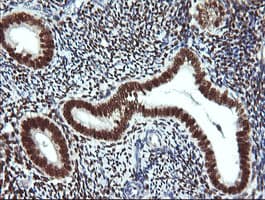 ER Alpha / Estrogen Receptor Antibody (clone OTI2E10)