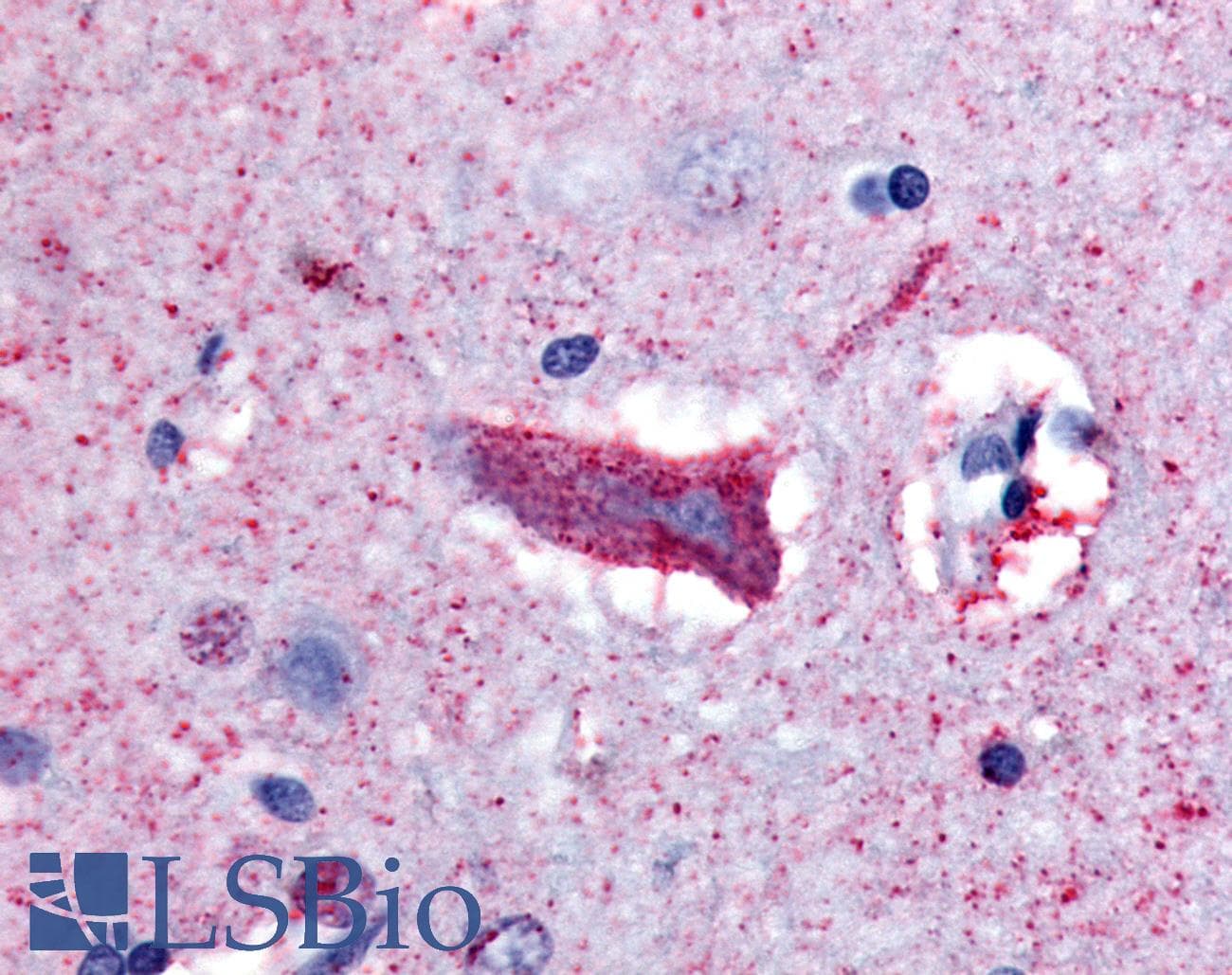 IHC-plus™ CHRM3 / M3 Antibody (Cytoplasmic Domain)