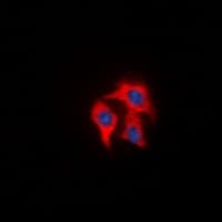 FAP Alpha Antibody (Internal)