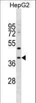 MPPED1 Antibody (aa140-168)