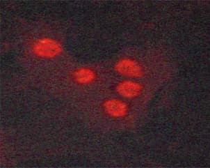 DDIT3 / CHOP Antibody (phospho-Ser30)