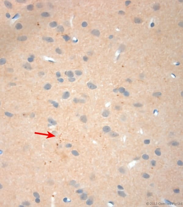NGF Antibody (aa130-180)