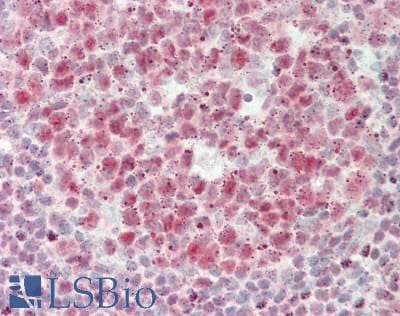 IHC-plus™ USP7 / HAUSP Antibody (aa1-50)