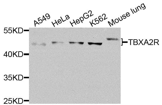 Polyclonal Rabbit anti-Human Thromboxane A2 Receptor Antibody (WB)