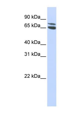 Polyclonal Rabbit anti-Human ZBTB48 / HKR3 Antibody (aa468-517, WB)