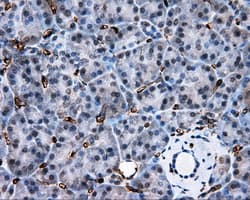 AKR1A1 Antibody (clone OTI4G6)