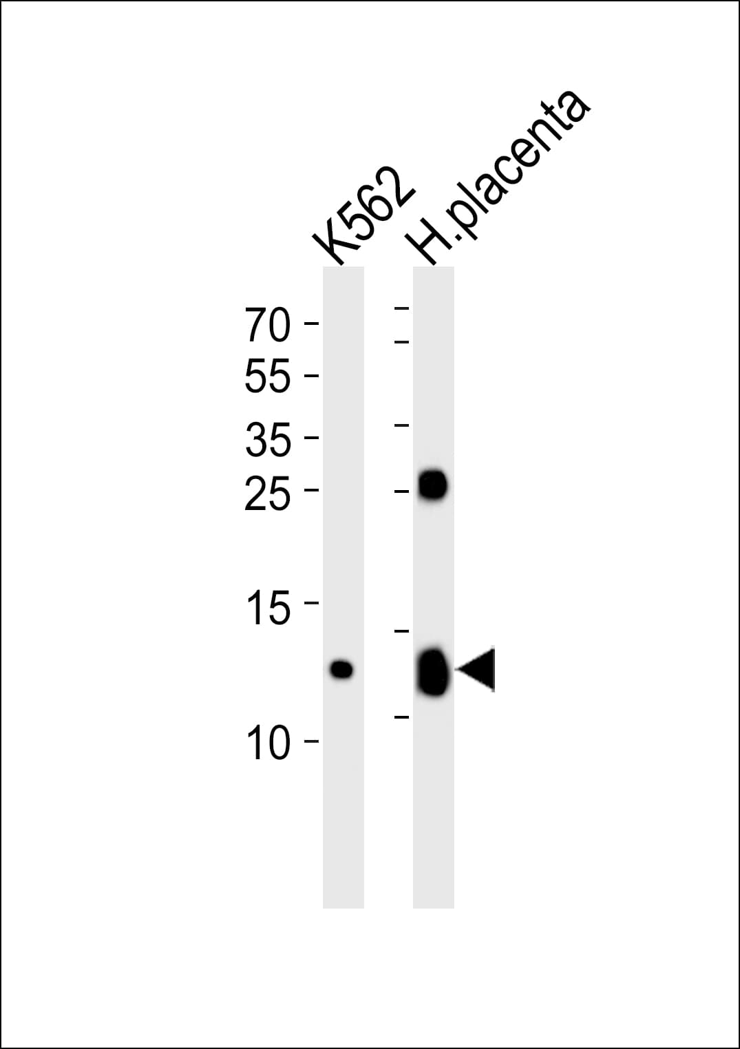 HBG2 / Hemoglobin Gamma 2 Antibody (aa101-133)