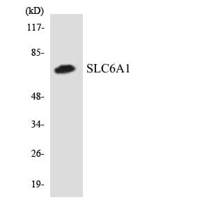 IHC-plus™ SLC6A1 / GAT-1 Antibody (aa372-421)