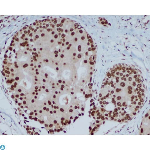 CBX5 / HP1 Alpha Antibody