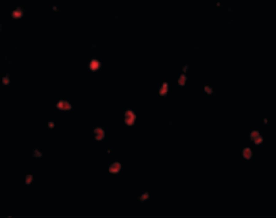 IHC-plus™ Polyclonal Rabbit anti-Human CD82 Antibody (IHC, IF, WB)