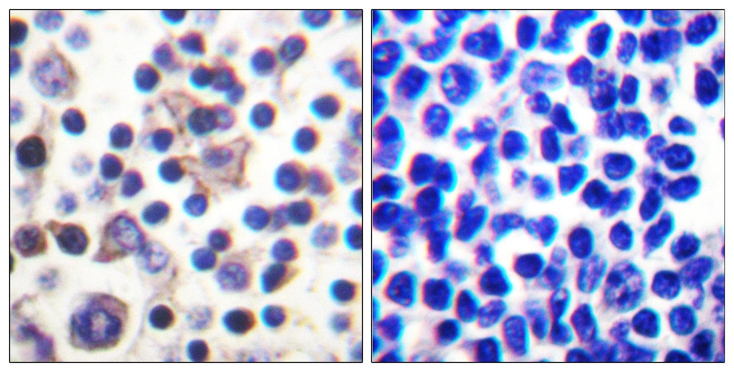 IL9R / CD129 Antibody (phospho-Ser519)