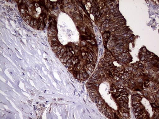 AGR2 Antibody (aa21-175, clone OTI3B5, Carrier-free)