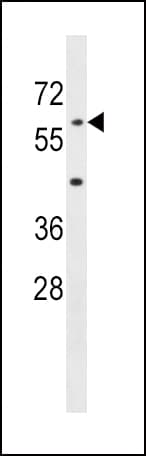 AOAH / Acyloxyacyl Hydrolase Antibody (aa168-197)