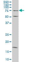 TRIM16 Antibody (clone 5G11)