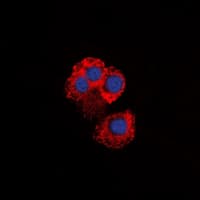 IKBKG / NEMO / IKK Gamma Antibody (Internal)