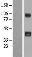 CCN3 / NOV Protein (Over-Expression Lysate Myc-DDK (Flag))